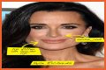 Botox, Implants & More! – Hollywood Life